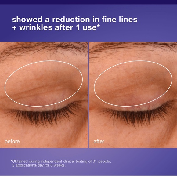 Dermalogica Phyto Nature Lifting Eye Cream 15ml - Picture 9 of 11